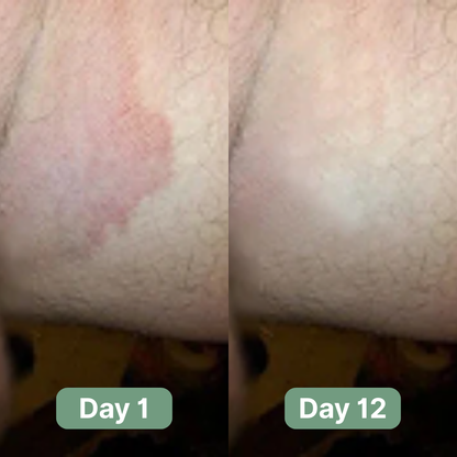 Seravinn Antifungal Soap