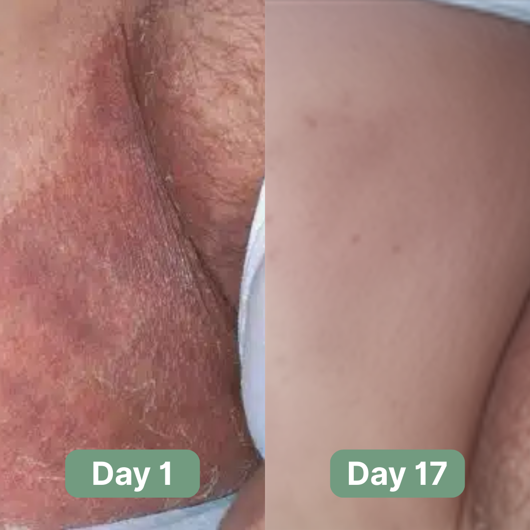 Seravinn Antifungal Soap