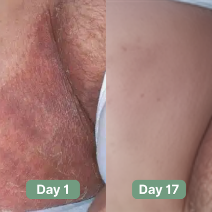 Seravinn Antifungal Soap